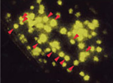 Second harmonic microscopic image of starch particles in a plant